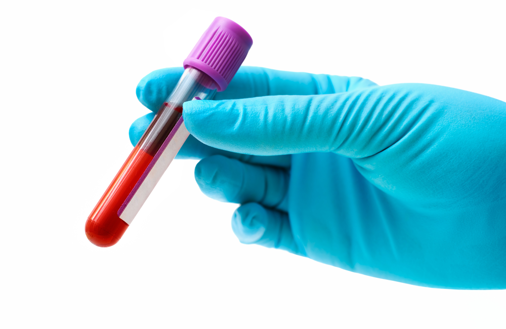 Image: iStock A close-up of somebody's hand in a blue surgical glove holding a vial of blood hand.