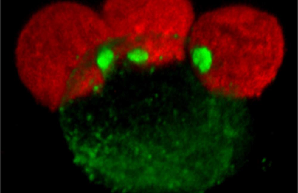 An infected cell, outlined by the green fluorescent HIV it contains, transmits HIV to uninfected target cells (in red). Photo: Benjamin K. Chen, Mount Sinai School of Medicine.