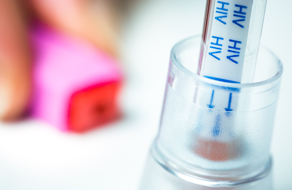 An empty vial marked with the word "HIV" resting in a test tube. 