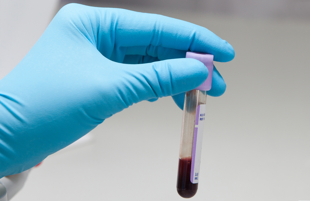 A close-up of somebody's hand. They are wearing blue surgical gloves and holding a vial that contains a small amount of blood. The image has a pink and purple filter over it.  