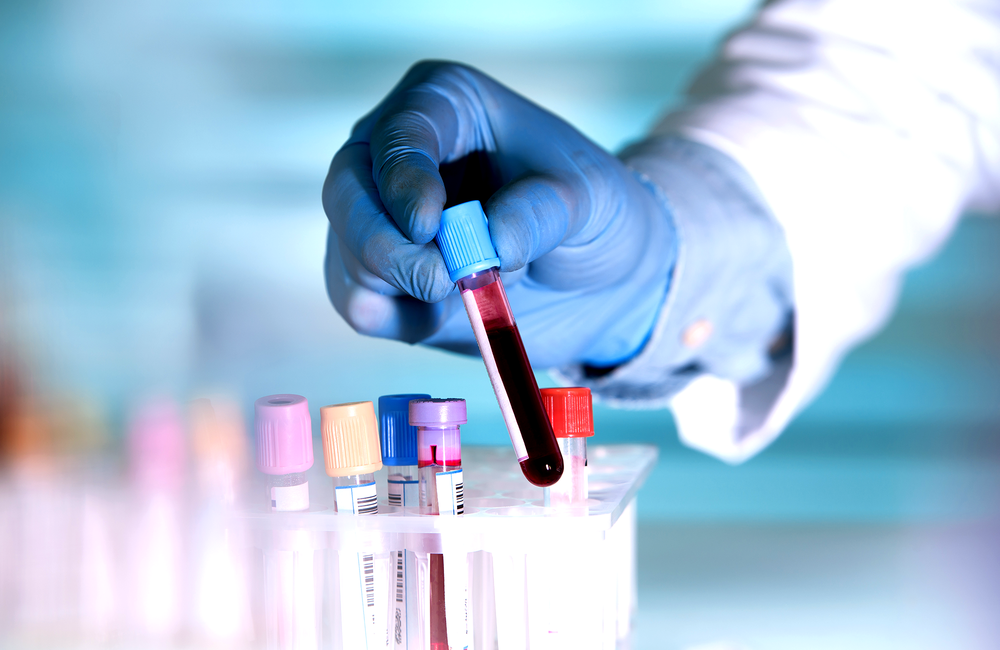 Image: angellodeco/Shutterstock.com A close-up of somebody's hand. They are wearing blue surgical gloves and holding a vial that contains a small amount of blood. The image has a pink and purple filter over it.