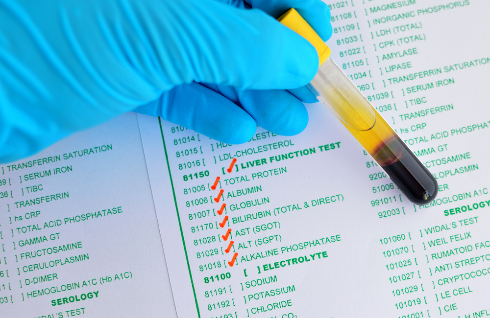 Alt test Diagnosing Liver