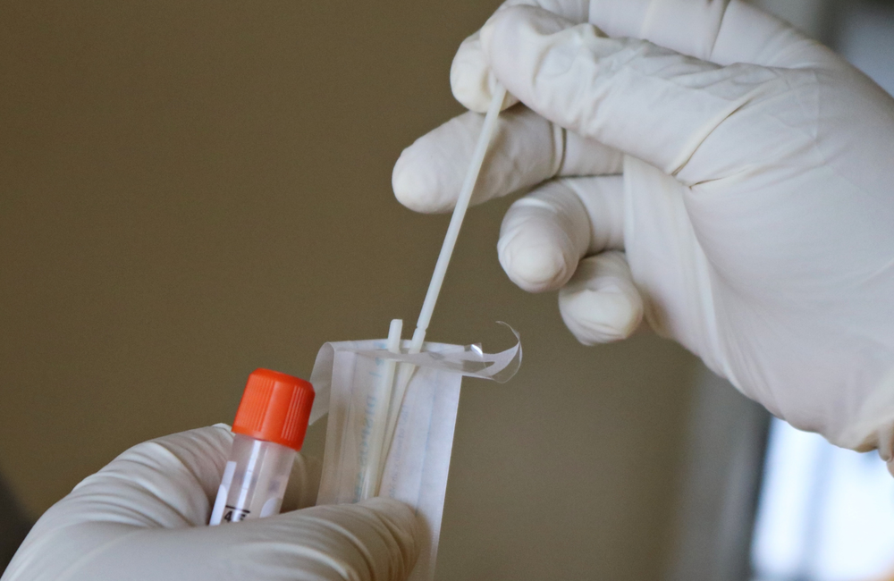 Mufid Majnun/Unsplash A swab used for STI testing. Mufid Majnun/Unsplash
