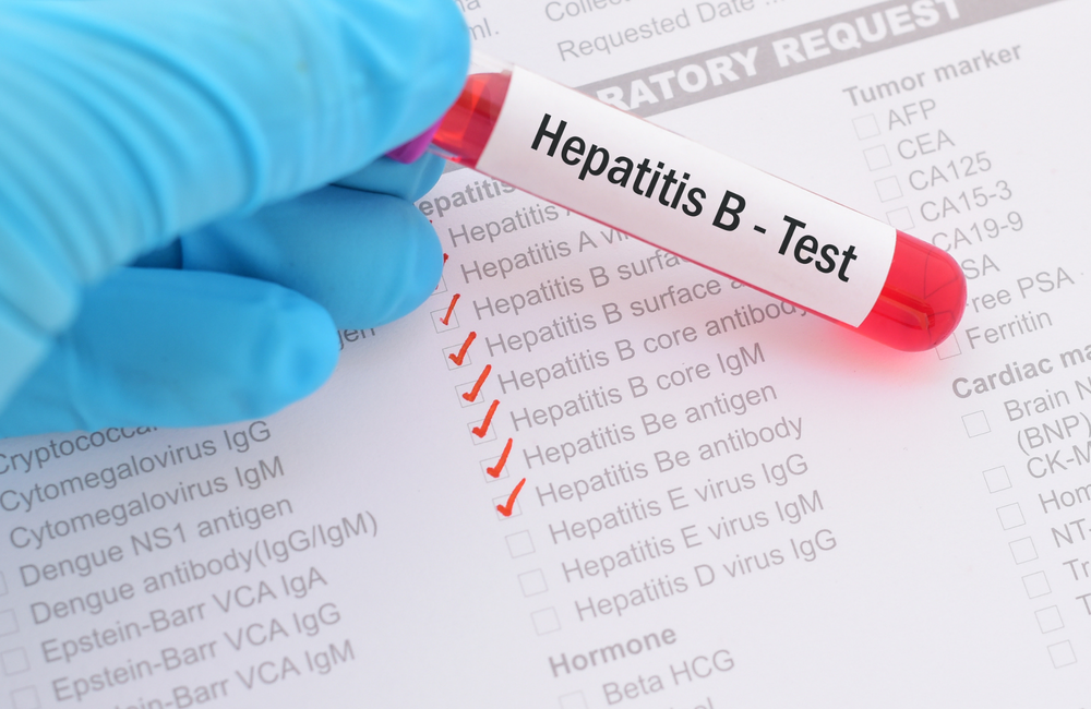 A hepatitis B test vial is held by a hand wearing a blue surgical glove.