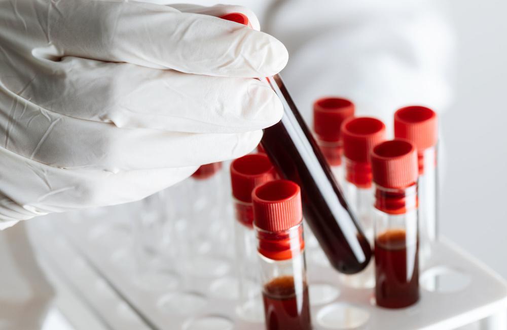 A hand in white gloves holds a tray of vials of blood samples.