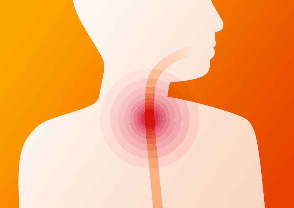 Fluconazole 60mg Cost